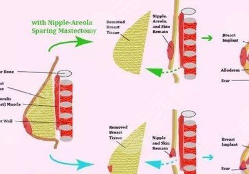 王愛武整形醫(yī)師醫(yī)術怎么樣？