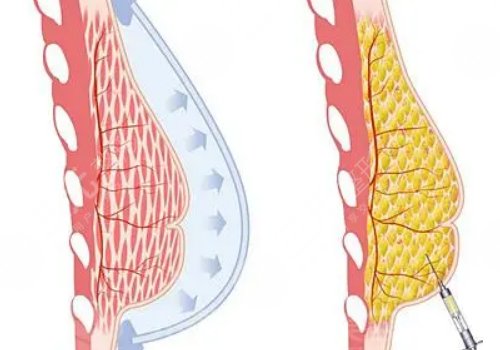 王愛武整形醫(yī)師醫(yī)術怎么樣？