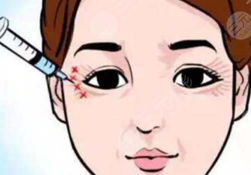 注射除皺眼部效果好嗎？