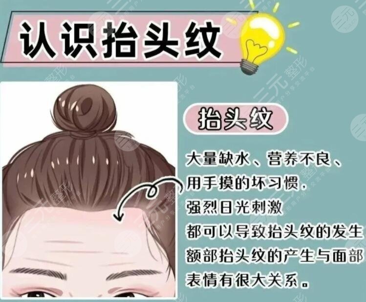 抬頭紋整形多少錢一般？哪些方法可以改良抬頭紋？