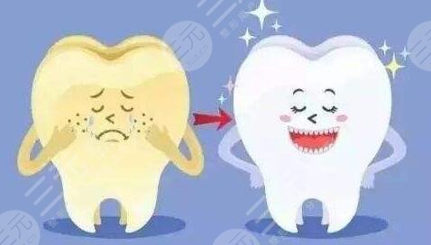 冷光美白牙齒要多少錢一次?