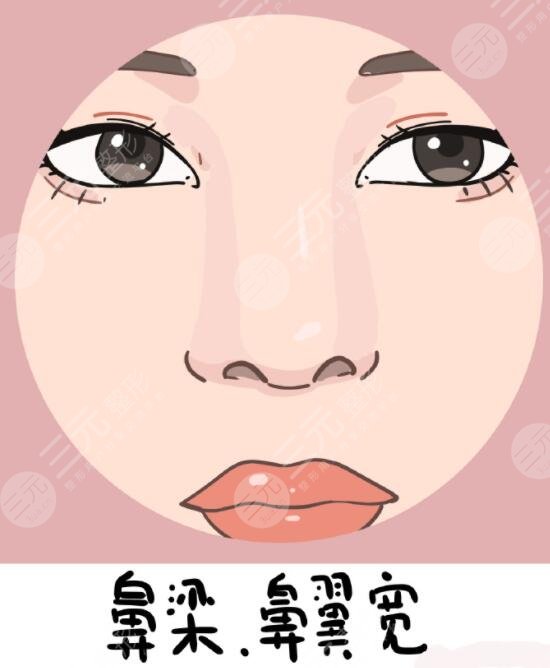 玻尿酸隆鼻的價(jià)格受到了哪些因素影響?