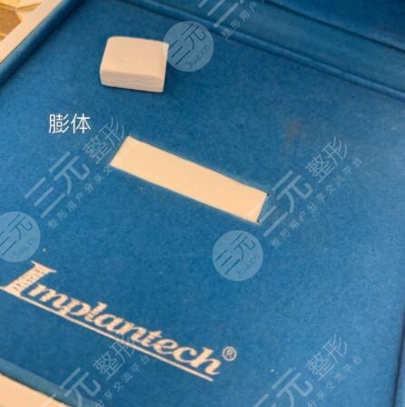 膨體隆鼻預(yù)防感染注意事項有哪些?