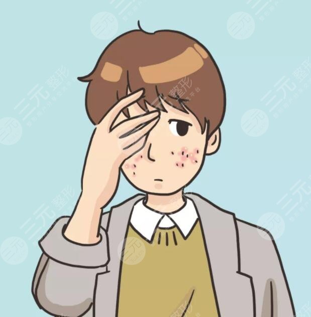 男生祛痘的小竅門是什么？做好這5點可以大大緩解痘肌！