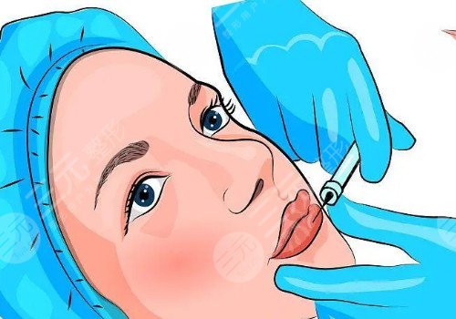 唇部注射玻尿酸多久可以恢復(fù)？