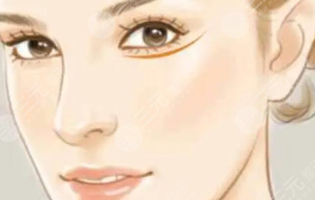 墊鼻梁有什么后遺癥和風(fēng)險？要盡量避免文中4種癥狀，否則修復(fù)！