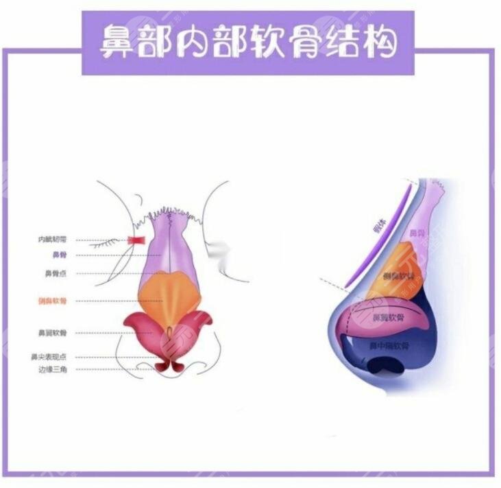 墊鼻梁有什么后遺癥和風(fēng)險?
