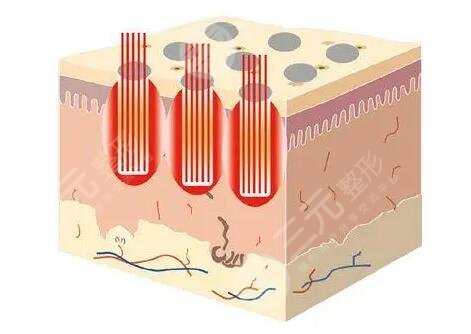 點陣像素激光是什么效果?