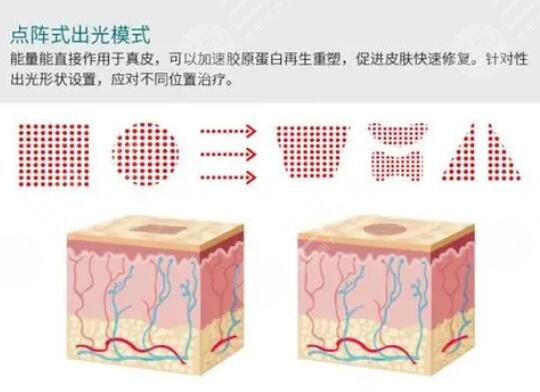 點陣像素激光是什么效果?