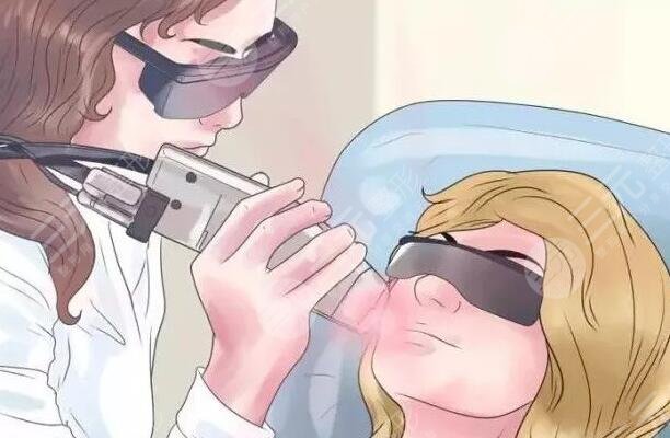 點陣像素激光是什么效果？做一次收費多少錢？作用及功效