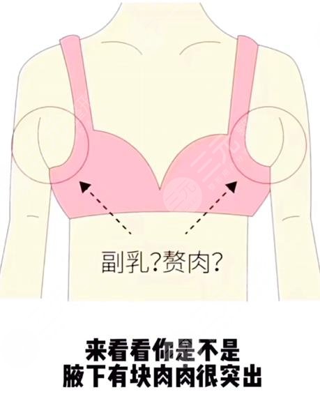 6大腋下副乳運動消除方法！4分鐘消除副乳！甩掉拜拜肉！