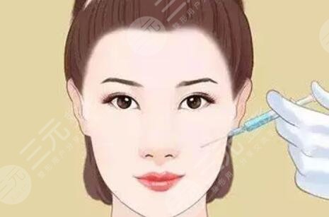 蘋(píng)果肌復(fù)位