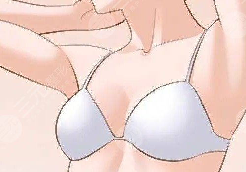 隆胸腋下切口的優(yōu)勢(shì)和缺點(diǎn)有哪些？