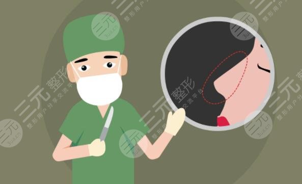 硅膠隆鼻前后對(duì)比效果差距明顯，直男看了都直呼‘側(cè)顏殺手’