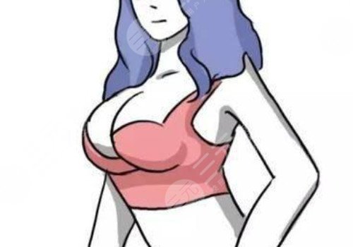 雙平面豐胸和普通豐胸的區(qū)別