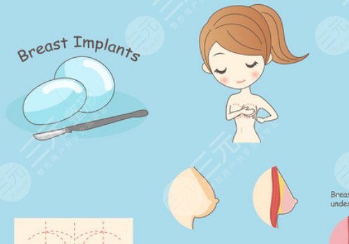 假體豐胸如何避免包膜痙攣？