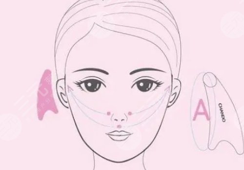 輪廓整形1個月和6個月對比圖