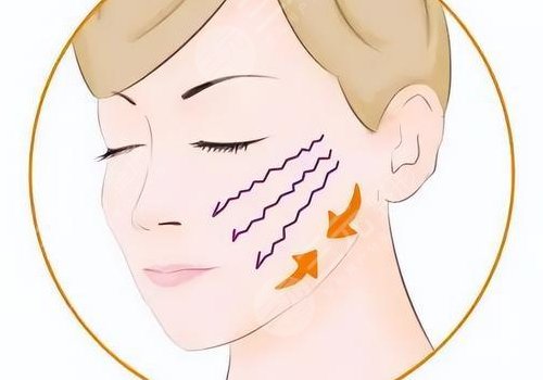 輪廓整形1個月和6個月對比圖