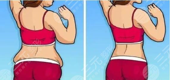 瘦腰豐胸運(yùn)動(dòng)有用嗎？常見的安全可靠的豐胸運(yùn)動(dòng)盤點(diǎn)！