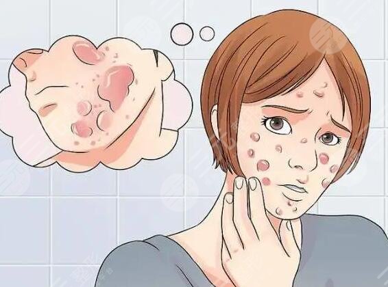 去痘印要多少錢一次？痘坑能修復(fù)嗎？怎么預(yù)防痘??？