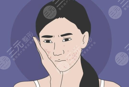 去痘印要多少錢一次?