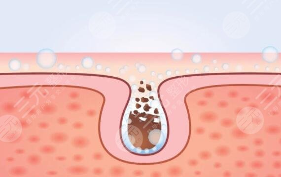 光動(dòng)力緩解