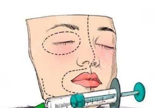 面部脂肪填充多久能恢復(fù)自然？