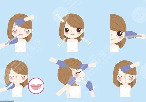 面部脂肪填充多久能恢復(fù)自然？