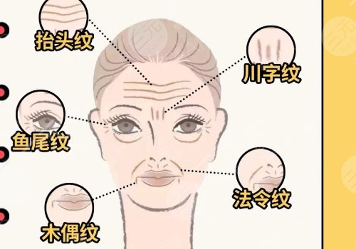 微調(diào)整形有風(fēng)險(xiǎn)嗎？