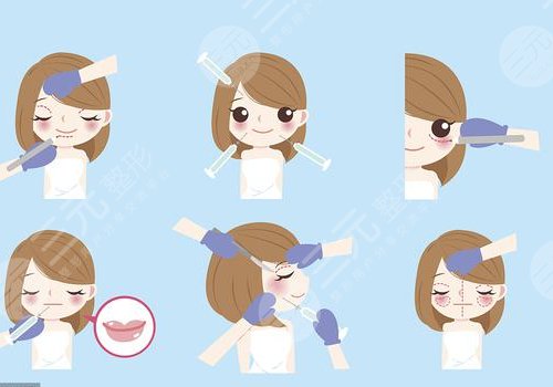 微調(diào)整形有風(fēng)險(xiǎn)嗎？