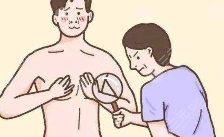 男性胸部吸脂多少錢？手術(shù)費(fèi)用價(jià)格表匯總！3家正規(guī)醫(yī)院介紹~