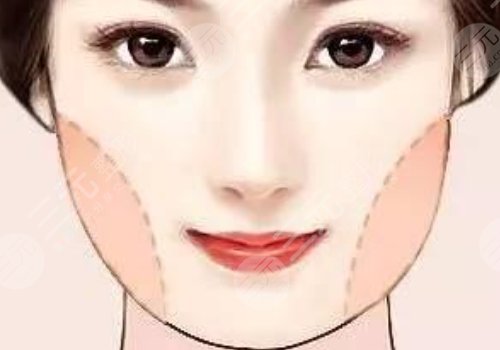 國(guó)字臉削骨手術(shù)風(fēng)險(xiǎn)大嗎？