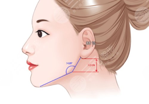 做臉部輪廓手術(shù)風(fēng)險高嗎？