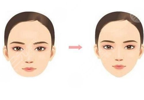 做臉部輪廓手術(shù)風(fēng)險高嗎？