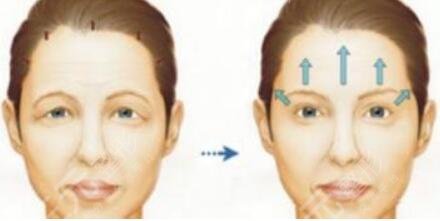 醫(yī)院和醫(yī)生的選擇