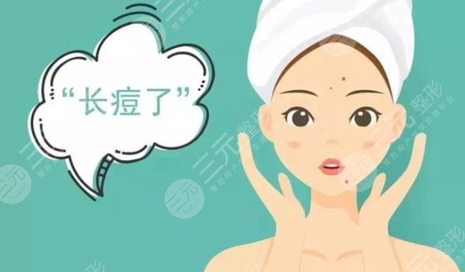 痤瘡佳緩解方法