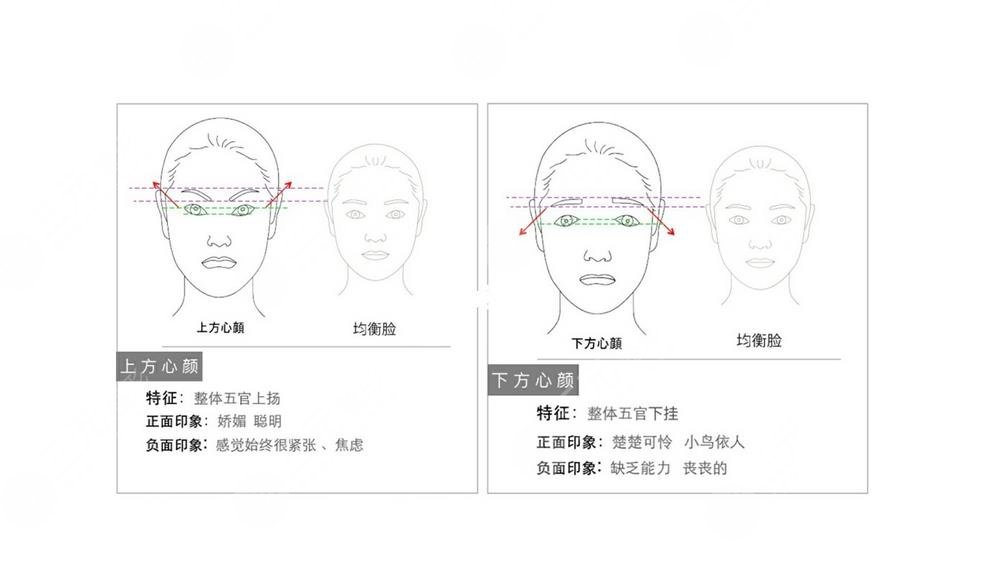 國(guó)字臉削骨手術(shù)風(fēng)險(xiǎn)大嗎？