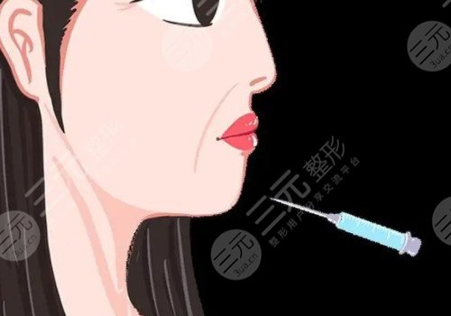 正規(guī)醫(yī)院注射除皺價格是多少？