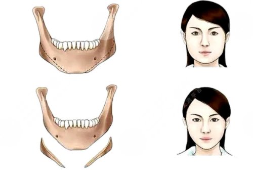 面部?jī)?nèi)輪廓和外輪廓區(qū)分