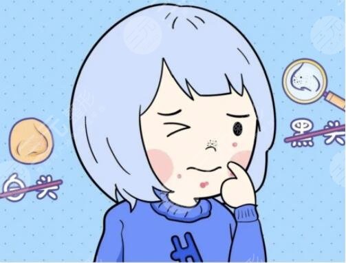 去黑頭有效的方法有哪些起效快速？5個(gè)好用的方法，一周一次