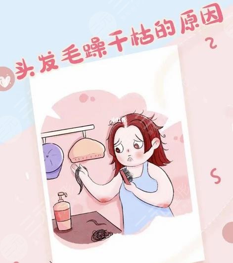 頭發(fā)毛躁干枯怎么改良