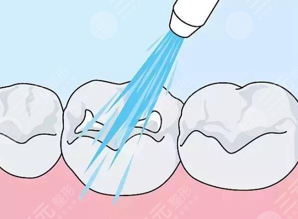 牙齒發(fā)黃變黑怎么辦?