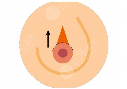 武漢美基元做胸的效果好嗎?