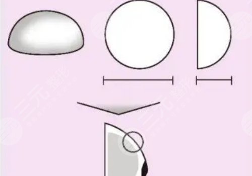 水滴形假體有光面的嗎？