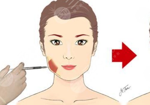 臉部微調(diào)大概多少錢？包括哪些項目？