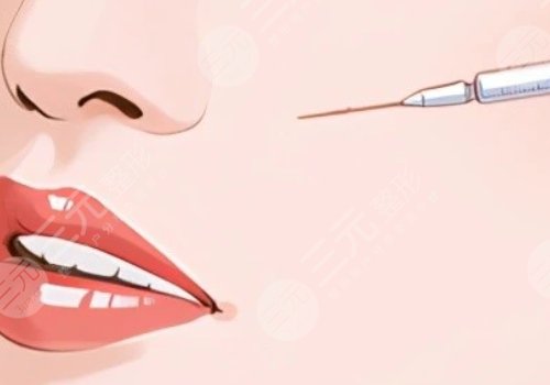 臉部微調(diào)大概多少錢？包括哪些項目？