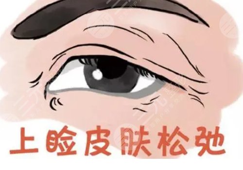 眼皮下垂解決方法有幾種？