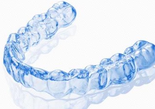 牙齒矯正多少錢價(jià)格表2023