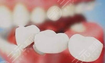 如何美白牙齒安全不傷牙？與大黃牙說byebye