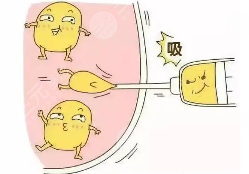 抽脂肪20斤一般多少錢?